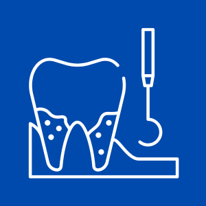 LIMPIEZA-DENTAL-AVANZADA