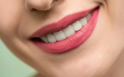 Blanqueamiento Dental en Parla: Consigue una Sonrisa Radiante